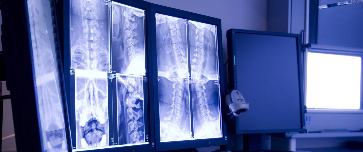 Radiologie apparatuur